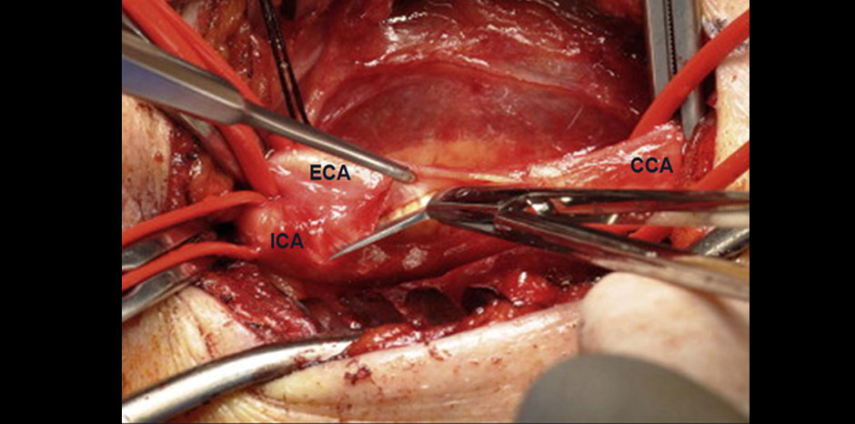 Carotid images1