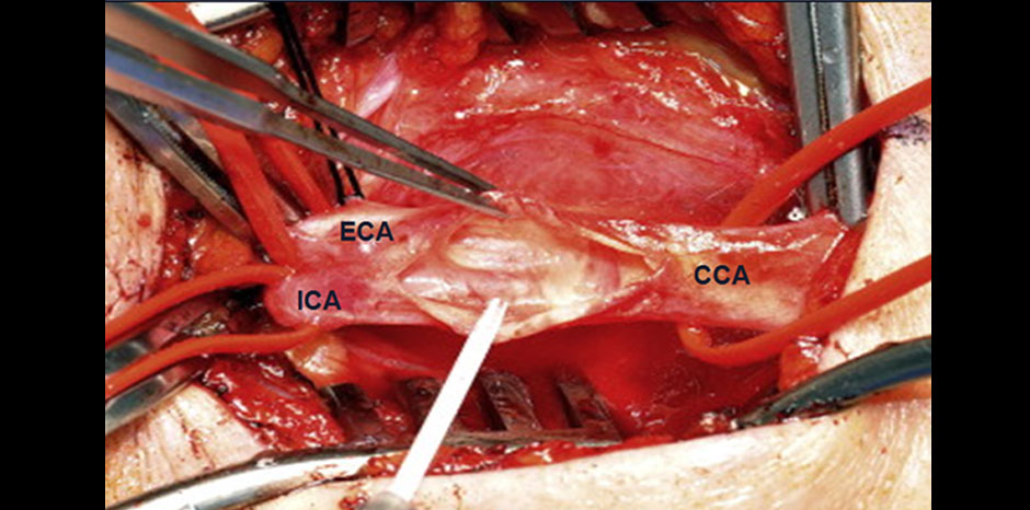 Carotid images2